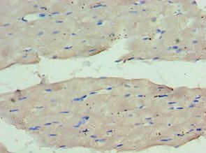 WDR77 / MEP50 Antibody - Immunohistochemistry of paraffin-embedded human skeletal muscle using antibody at 1:100 dilution.