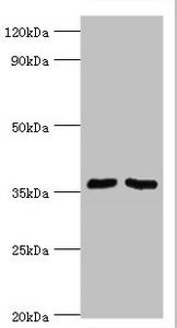 WDR77 / MEP50 Antibody - Western blot All lanes: Methylosome protein 50 antibody at 6µg/ml Lane 1: Hela whole cell lysate Lane 2: HepG2 whole cell lysate Secondary Goat polyclonal to rabbit IgG at 1/10000 dilution Predicted band size: 37, 30 kDa Observed band size: 37 kDa