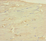 WDR77 / MEP50 Antibody - Immunohistochemistry of paraffin-embedded human skeletal muscle tissue using WDR77 Antibody at dilution of 1:100