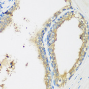 WDR77 / MEP50 Antibody - Immunohistochemistry of paraffin-embedded human prostate.