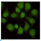 WDR77 / MEP50 Antibody - Immunocytochemistry staining of HeLa cells fixed in 1% Paraformaldehyde and then permeabilized in 0. 1% Triton X-100, next using WDR77 mouse mAb (dilution 1:100).