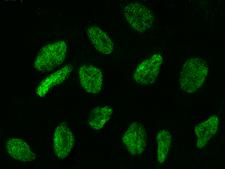 WDR77 / MEP50 Antibody - Immunofluorescence staining of WDR77 in U2OS cells. Cells were fixed with 4% PFA, permeabilzed with 0.3% Triton X-100 in PBS, blocked with 10% serum, and incubated with rabbit anti-human WDR77 polyclonal antibody (dilution ratio 1:1000) at 4°C overnight. Then cells were stained with the Alexa Fluor 488-conjugated Goat Anti-rabbit IgG secondary antibody (green). Positive staining was localized to nucleus.