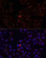 WDR81 Antibody - Immunofluorescence analysis of HeLa cells using WDR81 antibody at dilution of 1:100. Blue: DAPI for nuclear staining.