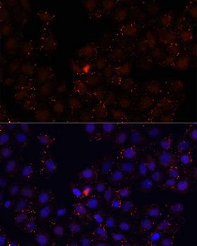 WDR81 Antibody - Immunofluorescence analysis of HeLa cells using WDR81 antibody at dilution of 1:100. Blue: DAPI for nuclear staining.