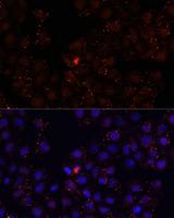WDR81 Antibody - Immunofluorescence analysis of HeLa cells using WDR81 Polyclonal Antibody at dilution of 1:100.Blue: DAPI for nuclear staining.