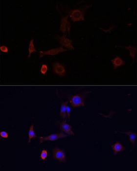 WDR81 Antibody - Immunofluorescence analysis of PC12 cells using WDR81 Polyclonal Antibody at dilution of 1:100.Blue: DAPI for nuclear staining.