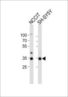 WDR82 / TMEM113 Antibody - Western blot of lysates from NCCIT, SH-SY5Y cell line (from left to right) with WDR82 Antibody. Antibody was diluted at 1:1000 at each lane. A goat anti-rabbit IgG H&L (HRP) at 1:10000 dilution was used as the secondary antibody. Lysates at 20 ug per lane.