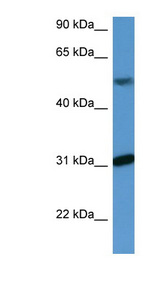 WDR83 Antibody - WDR83 antibody Western blot of Fetal Liver lysate.  This image was taken for the unconjugated form of this product. Other forms have not been tested.