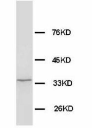 WDR83 Antibody -  This image was taken for the unconjugated form of this product. Other forms have not been tested.