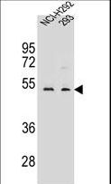 WDR86 Antibody - WDR86 Antibody western blot of NCI-H292,293 cell line lysates (35 ug/lane). The WDR86 antibody detected the WDR86 protein (arrow).