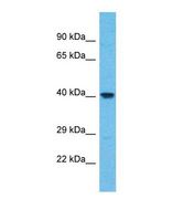 WDR86 Antibody - Western blot of Human HeLa. WDR86 antibody dilution 1.0 ug/ml.  This image was taken for the unconjugated form of this product. Other forms have not been tested.