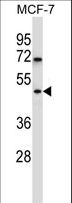 WDR88 Antibody - WDR88 Antibody western blot of MCF-7 cell line lysates (35 ug/lane). The WDR88 antibody detected the WDR88 protein (arrow).