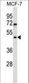 WDR88 Antibody - WDR88 Antibody western blot of MCF-7 cell line lysates (35 ug/lane). The WDR88 antibody detected the WDR88 protein (arrow).