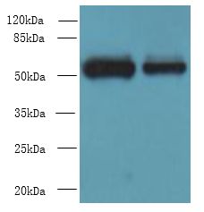 WDR88 Antibody - Western blot. All lanes: WDR88 antibody at 6 ug/ml. Lane 1: MCF7 whole cell lysate. Lane 2: A549 whole cell lysate. Secondary Goat polyclonal to Rabbit IgG at 1:10000 dilution. Predicted band size: 53 kDa. Observed band size: 53 kDa.