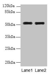 WDR88 Antibody - Western blot All lanes: WDR88 antibody at 6µg/ml Lane 1: MCF-7 whole cell lysate Lane 2: A549 whole cell lysate Secondary Goat polyclonal to rabbit IgG at 1/10000 dilution Predicted band size: 53, 48 kDa Observed band size: 53 kDa