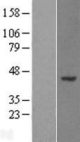 WDR89 Protein - Western validation with an anti-DDK antibody * L: Control HEK293 lysate R: Over-expression lysate