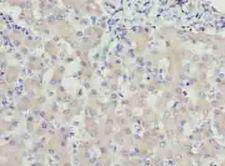 WDR91 Antibody - Immunohistochemistry of paraffin-embedded human liver tissue using antibody at dilution of 1:100.