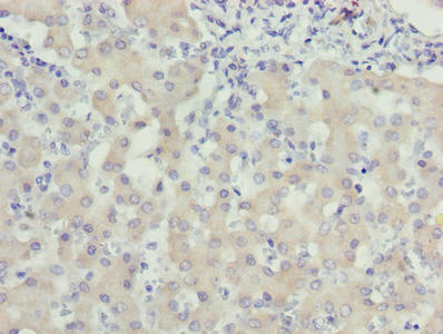 WDR91 Antibody - Immunohistochemistry of paraffin-embedded human liver tissue using WDR91 Antibody at dilution of 1:100