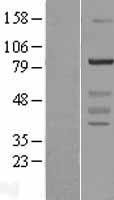 WDR91 Protein - Western validation with an anti-DDK antibody * L: Control HEK293 lysate R: Over-expression lysate