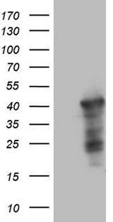 WDR92 Antibody - HEK293T cells were transfected with the pCMV6-ENTRY control. (Left lane) or pCMV6-ENTRY WDR92. (Right lane) cDNA for 48 hrs and lysed. Equivalent amounts of cell lysates. (5 ug per lane) were separated by SDS-PAGE and immunoblotted with anti-WDR92. (1:2000)