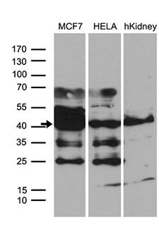WDR92 Antibody - Western blot analysis of extracts. (35ug) from 2 different cell lines and human kidney tissue lysate by using anti-WDR92 monoclonal antibody. (1:500)