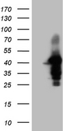 WDR92 Antibody - HEK293T cells were transfected with the pCMV6-ENTRY control. (Left lane) or pCMV6-ENTRY WDR92. (Right lane) cDNA for 48 hrs and lysed