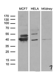 WDR92 Antibody - Western blot analysis of extracts. (35ug) from 2 different cell lines and human kidney tissue lysate by using anti-WDR92 monoclonal antibody. (1:500)
