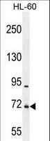 WDR93 Antibody - WDR93 Antibody western blot of HL-60 cell line lysates (35 ug/lane). The WDR93 antibody detected the WDR93 protein (arrow).