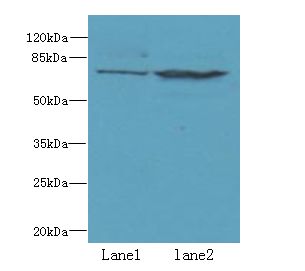 WDTC1 Antibody - Western blot. All lanes: WDTC1 antibody at 1.5 ug/ml. Lane 1: A431 whole cell lysate. Lane 2: Mouse liver tissue. Secondary Goat polyclonal to Rabbit IgG at 1:10000 dilution. Predicted band size: 76 kDa. Observed band size: 76 kDa.
