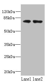WDTC1 Antibody - Western blot All lanes: WDTC1 antibody at 1.5µg/ml Lane 1: A431 whole cell lysate Lane 2: Mouse liver tissue Secondary Goat polyclonal to rabbit IgG at 1/10000 dilution Predicted band size: 76, 70, 68, 69 kDa Observed band size: 76 kDa