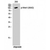 WEE1 Antibody - Western blot of Phospho-Wee1 (S642) antibody