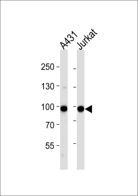 WEE1 Antibody - WEE1 Antibody (A159) western blot of A431, Jurkat cell line lysates (35 ug/lane). The WEE1 antibody detected the WEE1 protein (arrow).