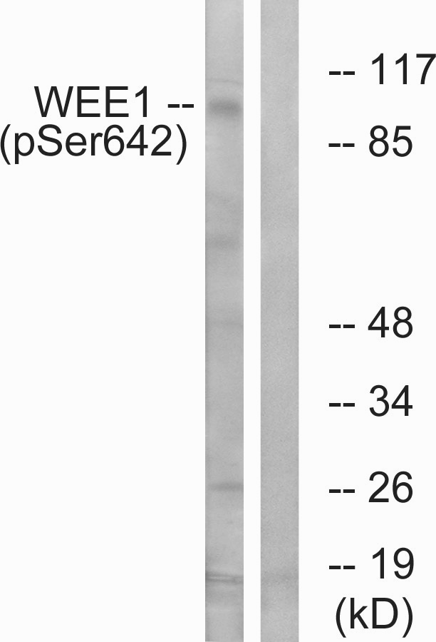 WEE1 Antibody - Western blot analysis of lysates from 293 cells treated with etoposide 25uM 60', using WEE1 (Phospho-Ser642) Antibody. The lane on the right is blocked with the phospho peptide.