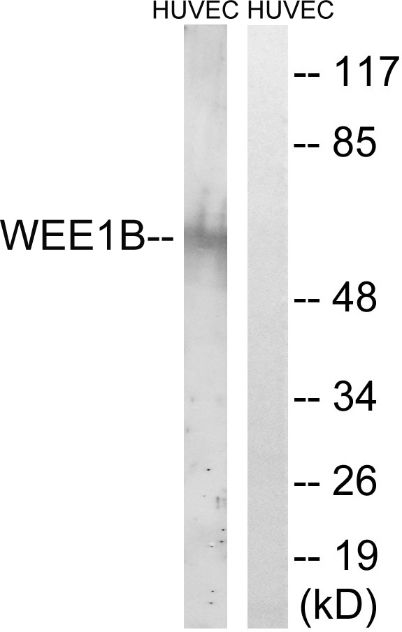 WEE1B / WEE2 Antibody - Western blot analysis of lysates from HUVEC cells, using WEE2 Antibody. The lane on the right is blocked with the synthesized peptide.