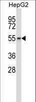 WEE1B / WEE2 Antibody - Mouse Wee2 Antibody western blot of HepG2 cell line lysates (35 ug/lane). The Wee2 antibody detected the Wee2 protein (arrow).
