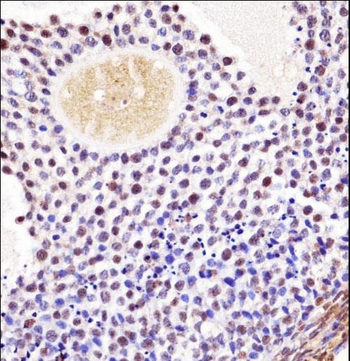 WEE1B / WEE2 Antibody - Mouse Wee2 Antibody immunohistochemistry of formalin-fixed and paraffin-embedded mouse ovarian tissue followed by peroxidase-conjugated secondary antibody and DAB staining.