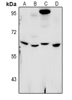 WEE1B / WEE2 Antibody - Western blot analysis of WEE2 expression in Hela (A), PC3 (B), MEF (C), rat testis (D) whole cell lysates.