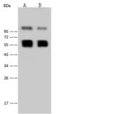 West Nile Virus NS1 Antibody - Anti-West Nile Virus(WNV)(lineage 1,strain NY99)NS1 rabbit polyclonal antibody at 1:2000 dilution. Sample: West Nile Virus(WNV)(lineage 1,strain NY99)NS1 Protein Recombinant Protein. Lane A: 30ng. Lane B: 10ng. Secondary: Goat Anti-Rabbit IgG (H+L)/HRP at 1/10000 dilution. Performed under reducing conditions.