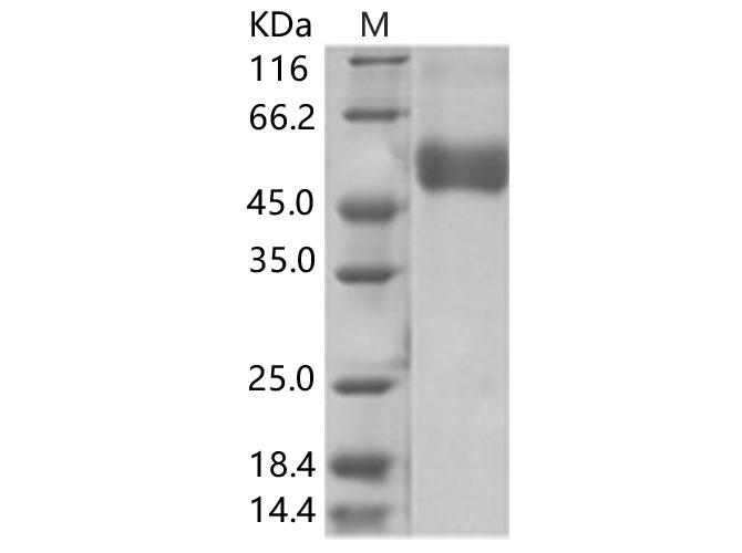 West Nile Virus NS1 Protein - Recombinant WNV (lineage 1, strain NY99) NS1 Protein (His Tag)