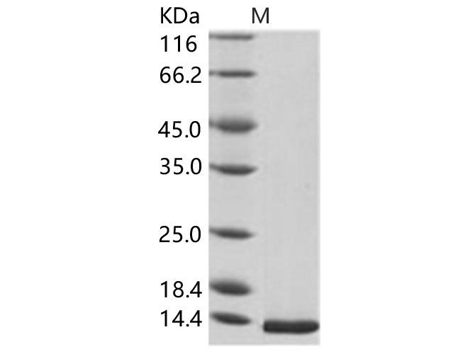 WNV E Protein - Recombinant WNV (lineage 1, strain NY99) E / Envelope Protein (Domain III, His Tag)