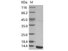 WNV E Protein - Recombinant WNV (lineage 2, strain Nea Santa-Greece-2010) E / Envelope Protein (Domain III, His Tag)