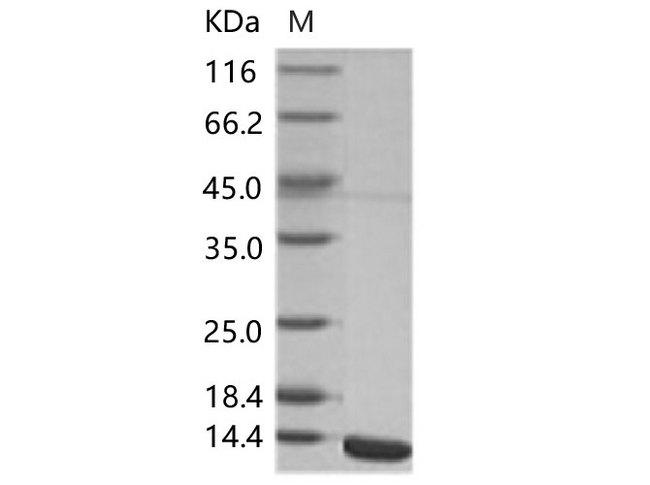 WNV E Protein - Recombinant WNV (lineage 2, strain Nea Santa-Greece-2010) E / Envelope Protein (Domain III, His Tag)