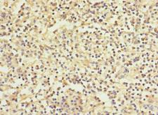 WFDC11 Antibody - Immunohistochemistry of paraffin-embedded human spleen tissue using WFDC11 Antibody at dilution of 1:100