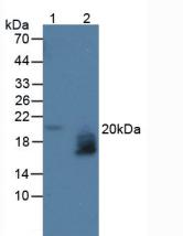 WFDC2 / HE4 Antibody - Western Blot; Sample: Lane1: Human Serum; Lane2: Human Urine.