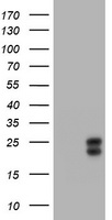 WFDC2 / HE4 Antibody - HEK293T cells were transfected with the pCMV6-ENTRY control (Left lane) or pCMV6-ENTRY WFDC2 (Right lane) cDNA for 48 hrs and lysed. Equivalent amounts of cell lysates (5 ug per lane) were separated by SDS-PAGE and immunoblotted with anti-WFDC2.