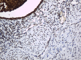 WFDC2 / HE4 Antibody - IHC of paraffin-embedded Human endometrium tissue using anti-WFDC2 mouse monoclonal antibody. (Heat-induced epitope retrieval by 10mM citric buffer, pH6.0, 120°C for 3min).