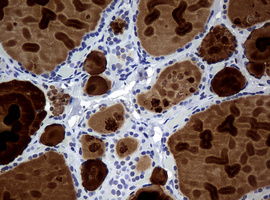 WFDC2 / HE4 Antibody - IHC of paraffin-embedded Human thyroid tissue using anti-WFDC2 mouse monoclonal antibody. (Heat-induced epitope retrieval by 10mM citric buffer, pH6.0, 120°C for 3min).