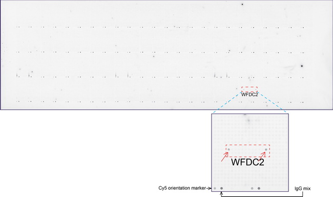 WFDC2 / HE4 Antibody - OriGene overexpression protein microarray chip was immunostained with UltraMAB anti-WFDC2 mouse monoclonal antibody. The positive reactive proteins are highlighted with two red arrows in the enlarged subarray. All the positive controls spotted in this subarray are also labeled for clarification.