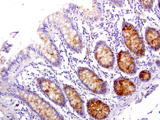 WFDC2 / HE4 Antibody - Immunohistochemical staining of paraffin-embedded human colon using anti-HE4 clone UMAB87 mouse monoclonal antibody at 1:200 dilution of 1.0 mg/mL using Polink2 Broad HRP DAB for detection.requires HIER with with citrate pH6.0 at 110C for 3 min using pressure chamber/cooker. The cells show membrane and cytoplasmic staining.