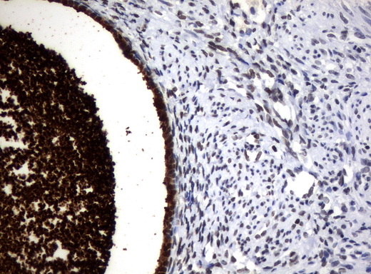 WFDC2 / HE4 Antibody - Immunohistochemical staining of paraffin-embedded Human endometrium tissue using anti-WFDC2 mouse monoclonal antibody.  heat-induced epitope retrieval by 10mM citric buffer, pH6.0, 120C for 3min)